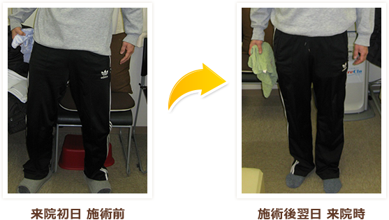 勤務先の医師に匙を投げられ整体に来ました。