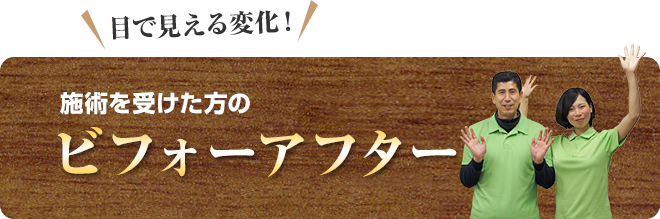 施術を受けた方のビフォーアフター