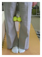 膝の関節の変形 / 膝痛 / 町田市在住 / 60代 / 女性