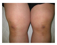 Y様 / 50代 / 主婦 / 町田市在住