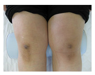 Y様 / 50代 / 主婦 / 町田市在住